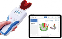 OccluSense Articulating & Pressure Indicator Digital Complete Kit (Bausch)