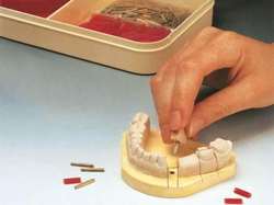 Crosspin (Nordent)