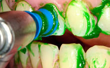 Kolorz Prophy Paste 200/Box (DMG)