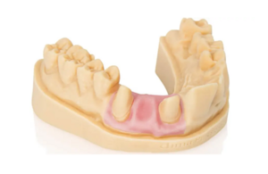 Dima Print Gingiva Mask 3D Resin Material – Pink, 1000 g Bottle (Kulzer)