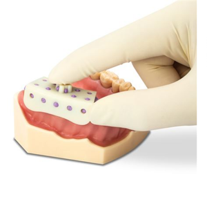 Micro-Tray Crown & Bridge Impression Tray 50/bx (Practicon)