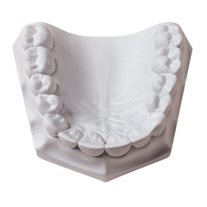 Mounting Plaster (Whipmix)