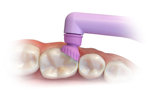 ProFlare Articulating Prophy Angles 125/bag (Premier)