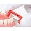 ContacEZ IPR Strips