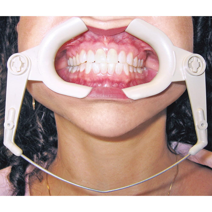 Cheek Retractor High Heat Wire Type Cheek Retractor High Heat Wire Type