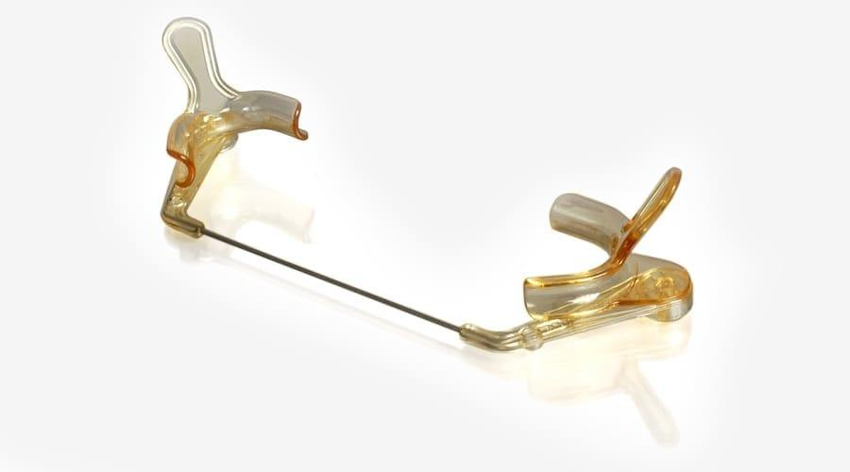 Free Access Cheek & Lip Retractor (J Mortia) Free Access Cheek & Lip Retractor (J Mortia)