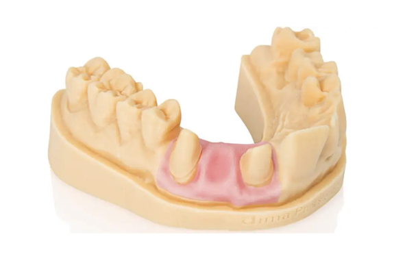 Dima Print Gingiva Mask 3D Resin Material – Pink, 1000 g Bottle (Kulzer) Dima Print Gingiva Mask 3D Resin Material – Pink, 1000 g Bottle (Kulzer)