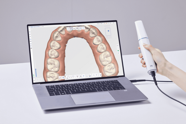 Intraoral Scanners